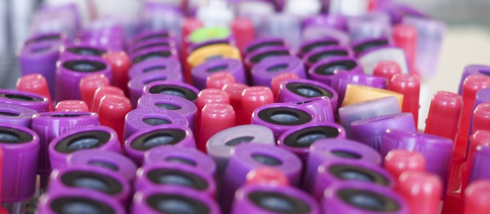 Viapath coloured test tubes